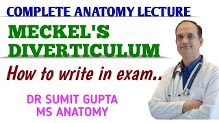 Meckels Diverticulum  Anatomy [upl. by Myca]