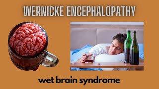 Wernicke Encephalopathy  Wet Brain Syndrome [upl. by Nelra]