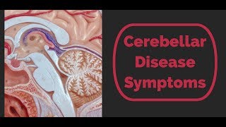 Cerebellar Disease Symptoms [upl. by Nytsirhc]