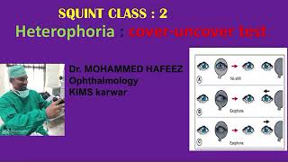 COVER uncover TEST  heterophoria  SQUINT CLASS  ophthalmology classes  strabismus [upl. by Eileek625]