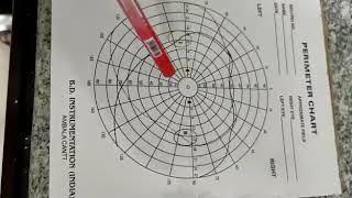 Perimetry 2 the perimeter chart [upl. by Ynobe196]