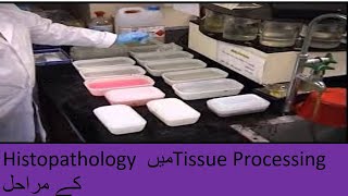 tissue processing in histopathology lab [upl. by Ycats142]