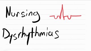 Nursing Dysrhythmias in 15 minutes Part 2 [upl. by Brenner897]