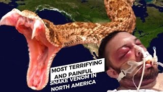 10 Most Terrifying and Painful Venomous Snake Bites In North America 🐍 [upl. by Osgood]