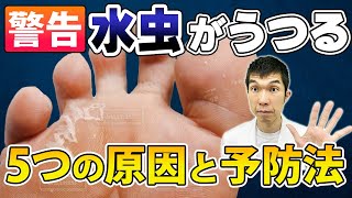 【警告！】水虫がうつる5つの原因と対処法【原因、症状、治療法、予防法】医師が解説 [upl. by Christye]