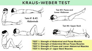 Kraus–Weber test unit 6kraus weber test in hindi [upl. by Saleme825]