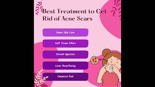 Best Treatment to Get Rid of Acne Scars [upl. by Kurtz716]