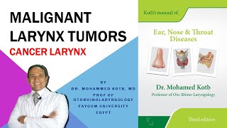 Malignant laryngeal tumors Cancer larynx Professor Dr Qotb [upl. by Eellac]