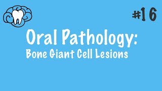 Oral Pathology  Giant Cell Lesions  INBDE ADAT [upl. by Aisenat204]