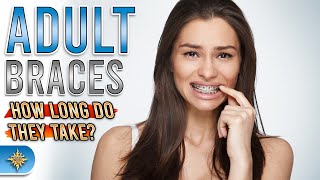 Adult Braces How Long Do They Take [upl. by Ddot]