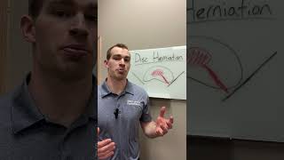 Understanding Disc Herniation and How Chiropractic Care Can Help at Skare Spine amp Performance [upl. by Atikkin]