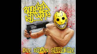 2014 Annoying Ringtone  Takyon Def Qon DIY Brain Surgery [upl. by Wailoo]