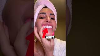 How To Whiten Your Teeth At Home 😧 [upl. by Gorski]