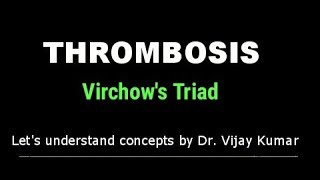 Thrombosis Pathology  Virchows Triad  Thrombus Formation  Pathology Lectures [upl. by Margaux]