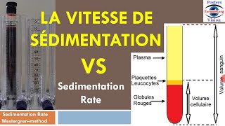 Methode Mesure de la vitesse de sedimentation rate VS ESR [upl. by Otit]