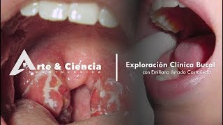 ►Exploración Clínica Bucal  Dr Emiliano Jurado Castañeda [upl. by Odella]