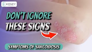 Don’t Ignore These Signs  Symptoms of Sarcoidosis  Granulomatous Disease [upl. by Drofla]