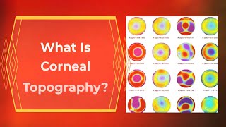 What is Corneal Topography [upl. by Nadnerb]