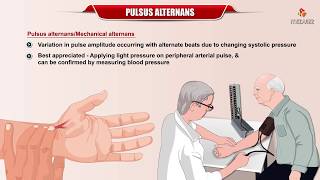 Pulses Alternans  Definition Etiology and Mechanism  Internal medicine  Usmle Cardiology [upl. by Bodi704]