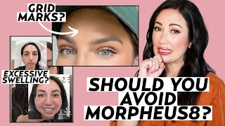 Morpheus8 Treatment Dermatologists Explain Radiofrequency Microneedling [upl. by Llerud120]