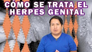 COMO ELIMINAR EL HERPES GENITAL [upl. by Ydasahc]