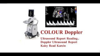 Doppler Ultrasound Report Reading In Urdu  Hindi [upl. by Cassandry]