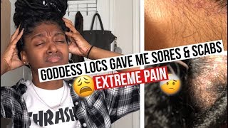 Getting Faux Locs Pain Sores amp Scabs  HeyLayah [upl. by Idissac]