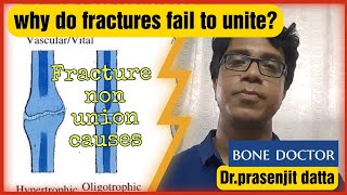 non union fracturescause of non union and delayed uniontypes of non uniontreatmentdr prasenjit [upl. by Airetnohs]