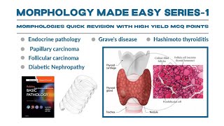 Morphology Series part 1Hashimoto thyroiditisGraves Diseasethyroiditis gravesdiseasemorpholgy [upl. by Frydman]