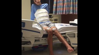 Spinal Cord Injury Recovery Video 11 [upl. by Peugia852]