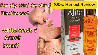 Summer acne facewashMust watch my Honest review before buying salysylic Alite facewash [upl. by Cymbre]