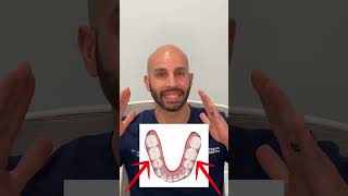 Orthodontist explains Invisalign to correct teeth shifting after previous braces treatment [upl. by Ahsataj]