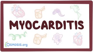 Myocarditis  causes symptoms diagnosis treatment pathology [upl. by Eyllek]