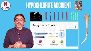 How to Avoid amp Treat the Hypochlorite Accident كيف نتجنب quotحادثة الهيبوكلوريتquot أثناء علاج العصب [upl. by Elfreda]