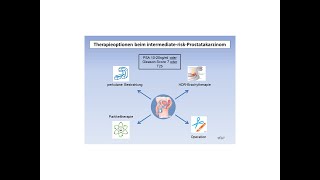 Therapieoptionen beim intermediateriskProstatakarzinom  Strahlentherapie Prof Hilke Vorwerk [upl. by Karlee104]