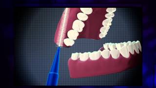 How to use an interdental brush effectively [upl. by Tecu]