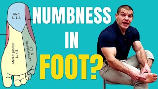 Numbness in Bottom of Foot 5 Causes and Solutions [upl. by Eldrida62]