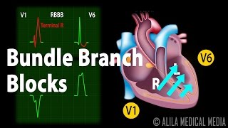 Bundle Branch Block Animation [upl. by Nakhsa]