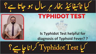 Is Typhidot Test helpful for diagnosis of Typhoid Fever [upl. by Biernat26]