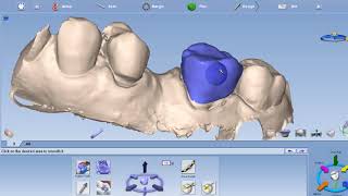 Clone crown to fit existing RPD [upl. by Hiett]