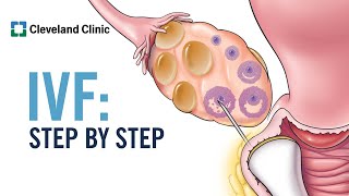 How Does In Vitro Fertilization IVF Work A StepbyStep Explanation [upl. by Auqeenahs873]