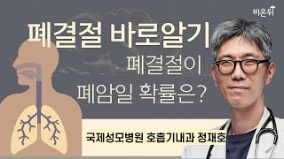 폐결절 바로알기  폐결절이 폐암일 확률은  국제성모병원 호흡기내과 정재호 [upl. by Leuamme]