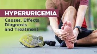 hyperuricemia and its Treatment Gout hyperuricaemia treatment drbadarkhan kneeepain jonpain [upl. by Eilama768]