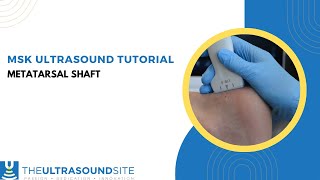 Musculoskeletal ultrasound evaluation of the metatarsal shaft [upl. by Adnamma]