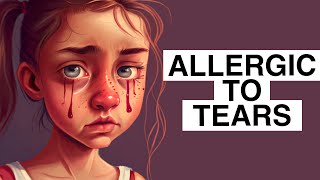 Im Allergic To Tears [upl. by Elnukeda]