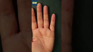 For Headache and Migraine Relief  Hand Acupuncture Acupressure [upl. by Brick477]