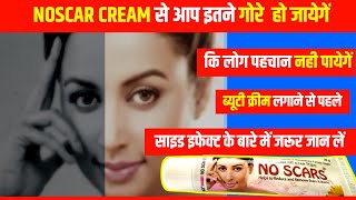 No Scars Cream Remove Face pigmentation Melasma Acne amp Pimples MarksNo scars cream review in hindi [upl. by Tarra]