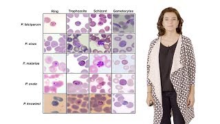 Maria Mota IMM 3 Nutrient sensing modulates malaria parasite virulence [upl. by Haras50]