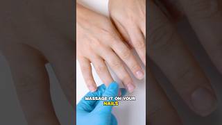 Nail Extension Gone Wrong  Remedy for Post Nail Care Treatment  Dr Nitika Kohli [upl. by Kelwunn]