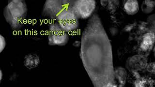 Labelfree Live Cell Imaging Tcells killing cancer cells  zoomedin [upl. by Alabaster157]